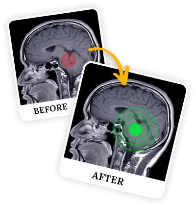 Billionaire Brain Wave Benefits