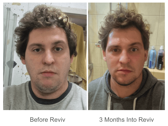 Reviv-Mouthguard-Customer-Reviews 